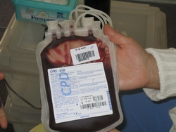  Cuba Increases Production of Blood Byproducts